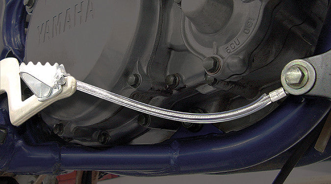 Pedal Anchor Kit